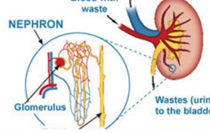 Nephrotic Syndrome: From simple to complex